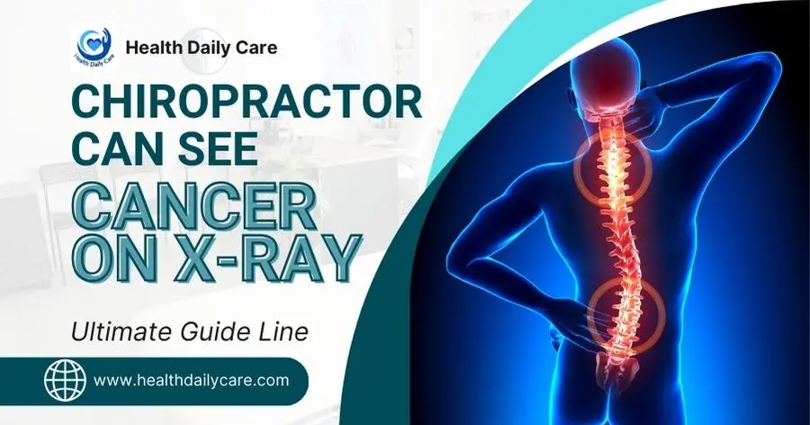 can-a-chiropractor-see-cancer-on-x-ray