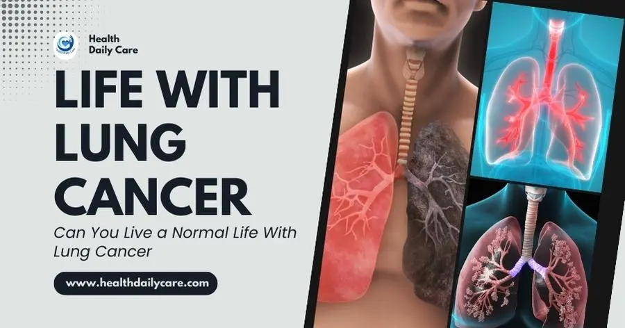 Can You Live a Normal Life With Lung Cancer