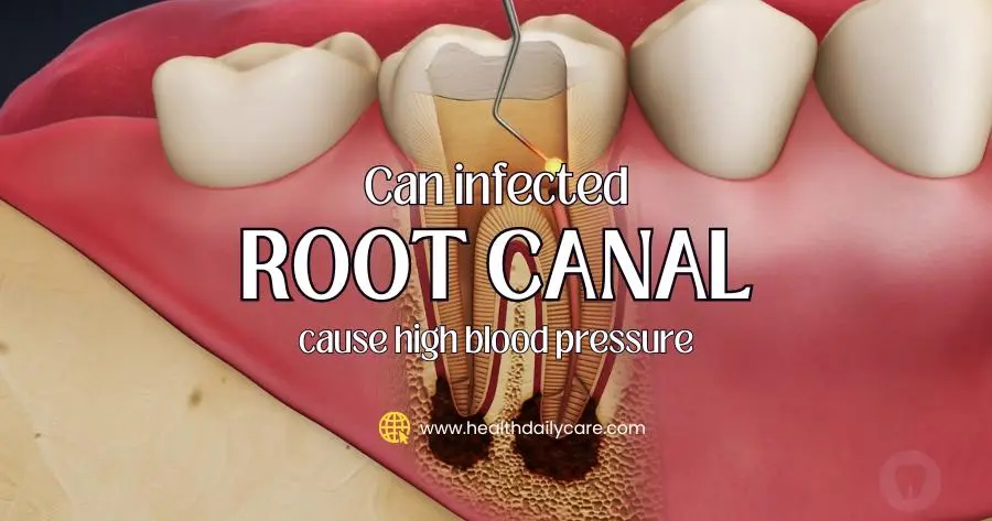 Can infected root canal cause high blood pressure