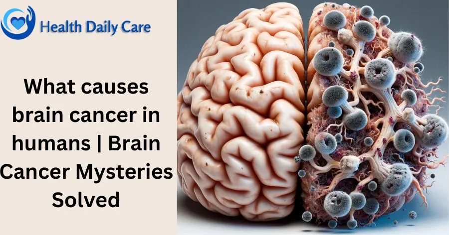 What causes brain cancer in humans